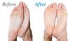 Emjoi Micro-Pedi 3D POWER Callus Remover with Xtreme Coarse Soft & Flexible Roller (Most Powerful & Corded) view 4