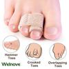 Welnove 6Pcs Hammer Toe Straightener, Hammer Toe Splints, Toe Wraps Cushioned Bandages for Correcting Hammer Toes, Broken, Bent, Curled, Crooked & Overlapping Toes (Beige) view 3